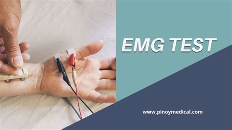 emg-ncv test price philippines|EMG Price in Philippines – Nerve Test With NCV NCS.